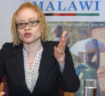 Au Malawi, les albinos menacés d’extermination par la sorcellerie - L'Onu s'en inquiète