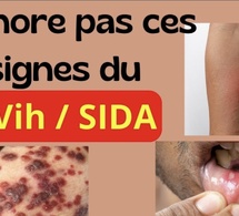 Contact avec une personne vivant avec le VIH : Que faire concrètement et sans paniquer ?