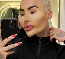 Il avait dépensé plus de 120 000 euros pour ressembler à Kim Kardashian : L’influenceur Jordan James Parke retrouvé mort à 34 ans