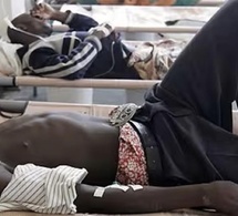 800 cas et 24 décès: Les chiffres préoccupants de la tuberculose à Kaolack