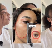 Le témoignage choc de l'influenceuse « Poupei Chinoiz », brisée par les violences conjugales